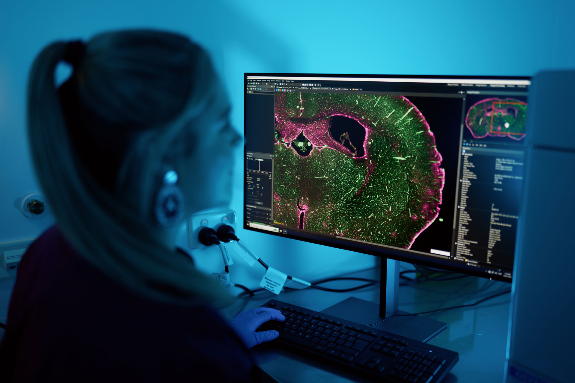 Biomedicine student viewing a magnified biological sample on a computer screen in a dimly lit room.